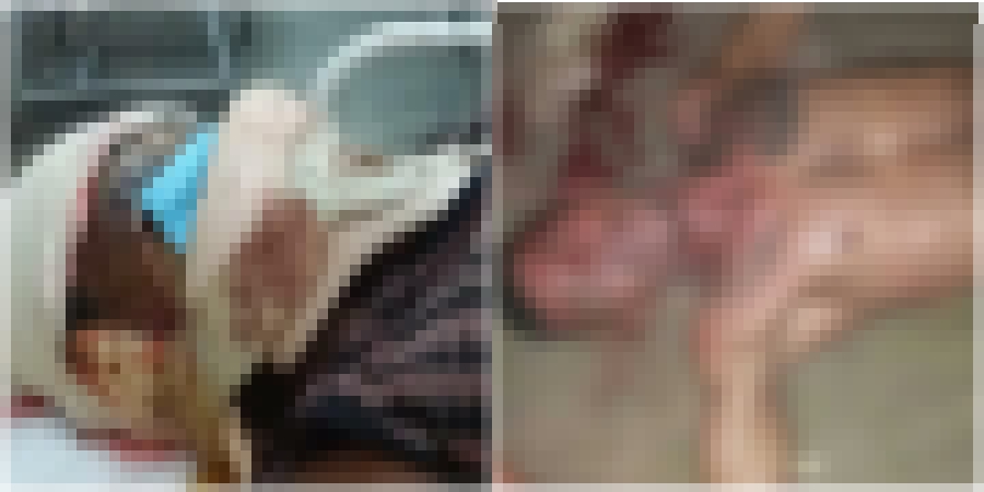 Mulher esfaqueia companheiro após vê-lo espancando sua mãe em Manaus; imagens fortes