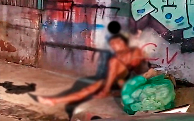 Homem leva quatro tiros e acaba sendo salvo pelo SAMU; imagens fortes
