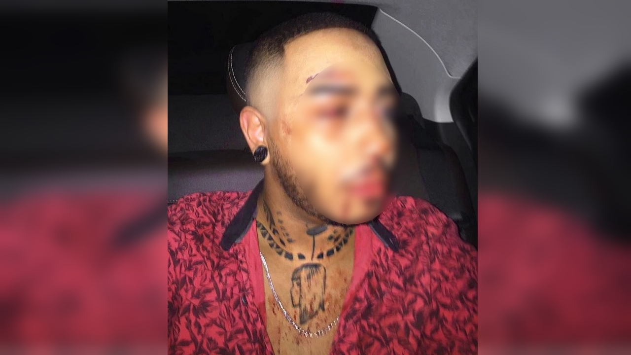 O feitiço virou contra o feiticeiro: Motorista de aplicativo grava assédio de homossexual agredido