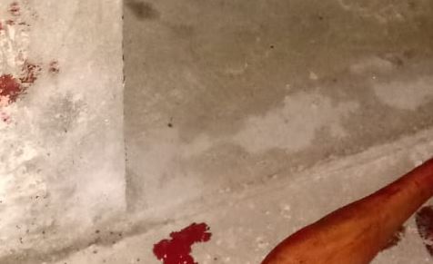 Mulher corta a garganta do marido que chegou bêbado querendo espancá-la; imagens fortíssimas
