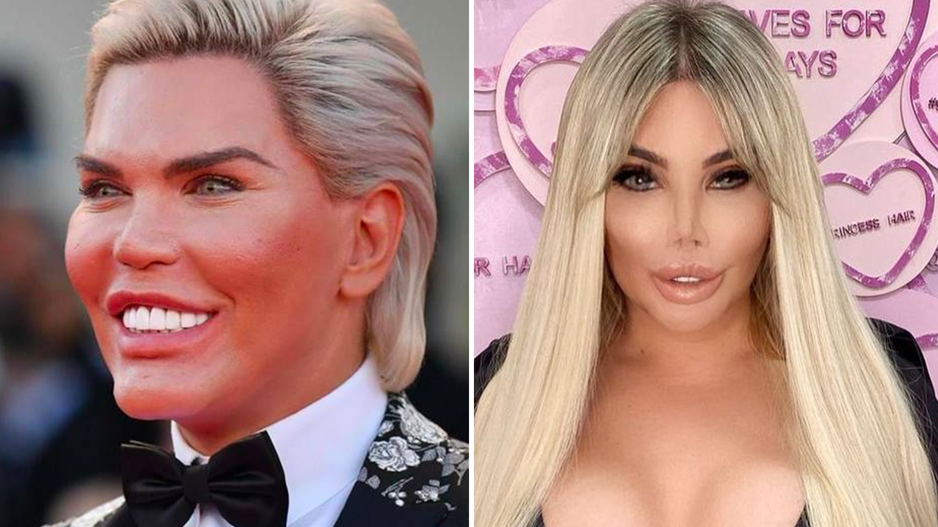 Ex-Ken humano, Jéssica Alves quer ser a primeira mulher transexual do mundo a realizar transplante de útero