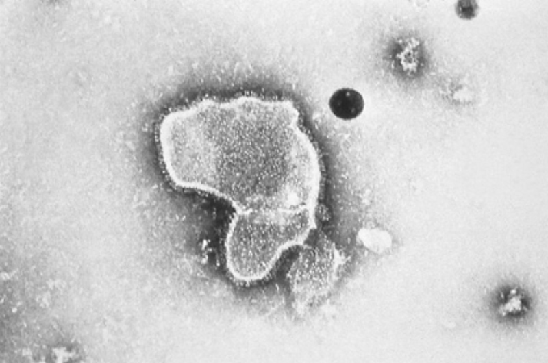 Casos de Influenza no Amazonas caem mas circulação do Vírus Sincicial Respiratório aumenta