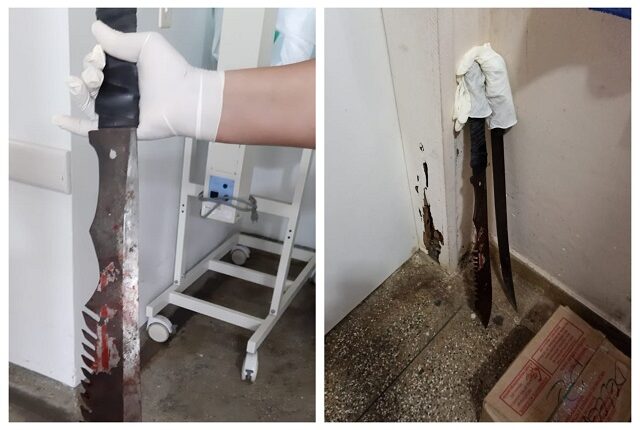 Trio fatia jovem a golpes de terçado e causa revolta no município de Maraã; veja fotos